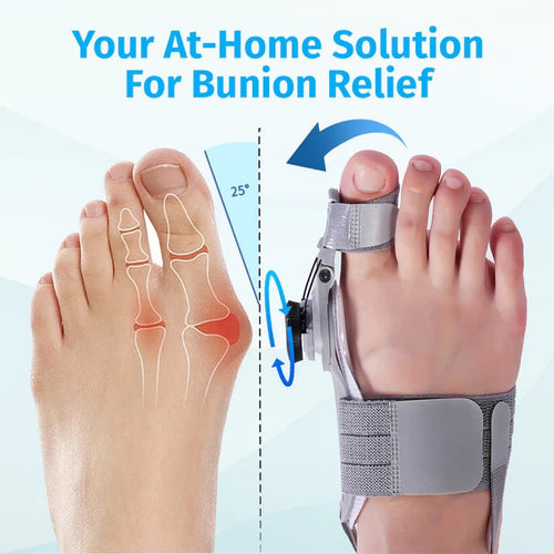 Bunion Corrector - FixBunion
